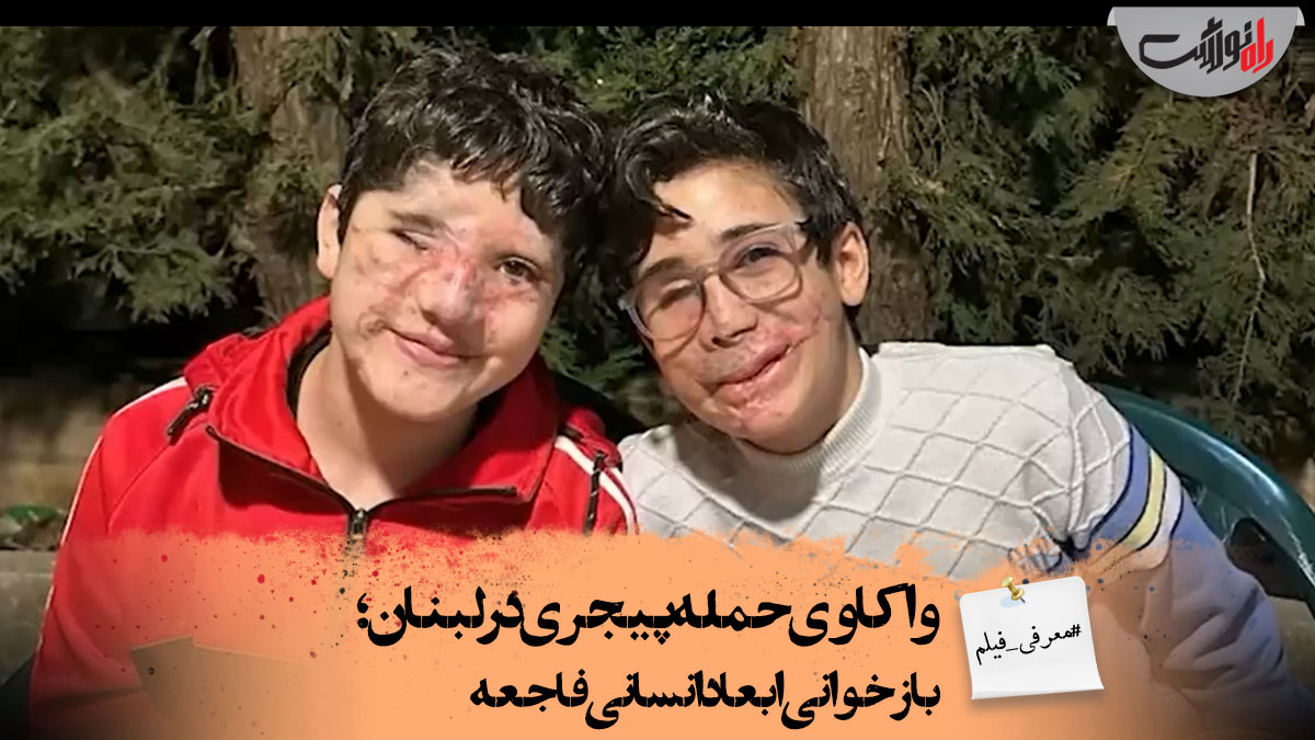 واکاوی حمله پیجری در لبنان؛ بازخوانی ابعاد انسانی فاجعه